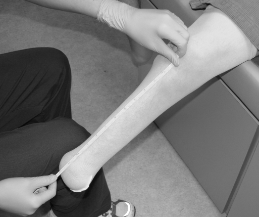 测量残肢